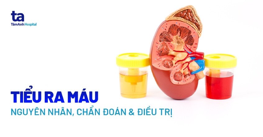 Người phụ nữ kiểm tra mẫu nước tiểu trong môi trường y tế.