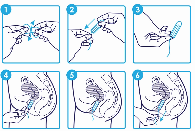 Các loại tampon với khả năng thấm hút khác nhau