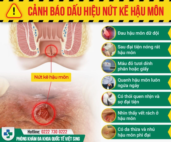 Hình ảnh minh họa bác sĩ khám hậu môn