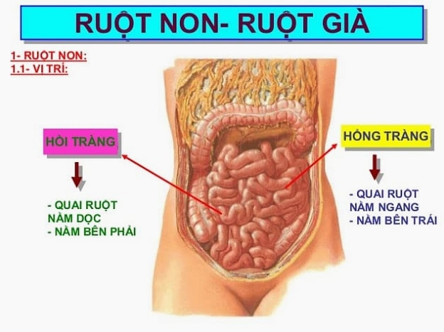 Hình ảnh minh họa về viêm hồi tràng