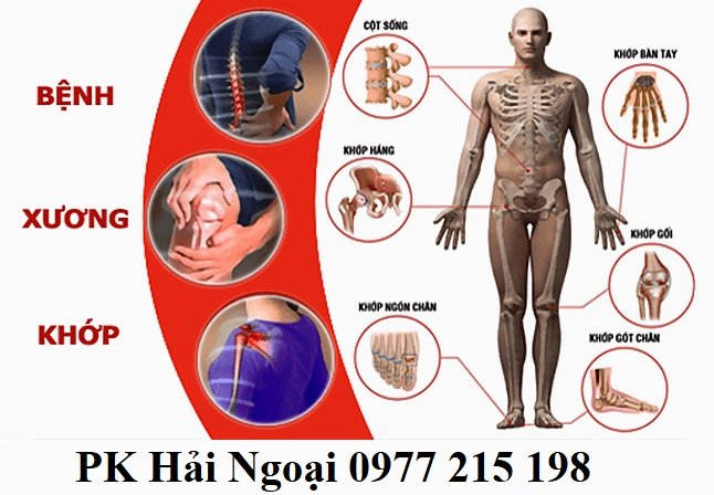 Khám Xương Khớp Ở Đâu Tốt Nhất 2026: Cẩm Nang Chuyên Sâu Khám xương khớp tại Thanh Hóa