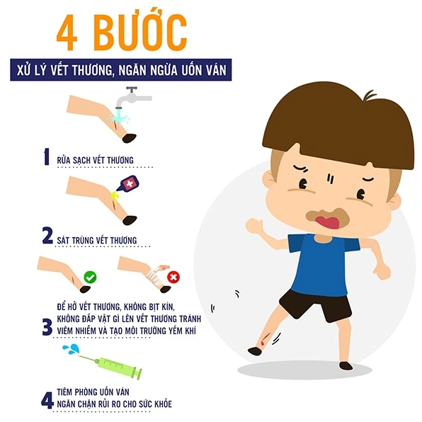 Uốn Ván: Hiểm Họa Khôn Lường và Cách Phòng Ngừa Toàn Diện Minh họa vi khuẩn uốn ván