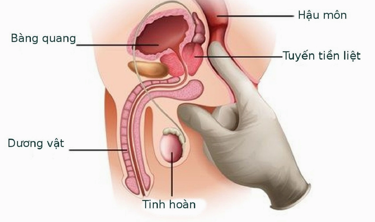 nieu-ao-la-gi-cau-tao-chuc-nang-va-cac-benh-ly-thuong-gap_853