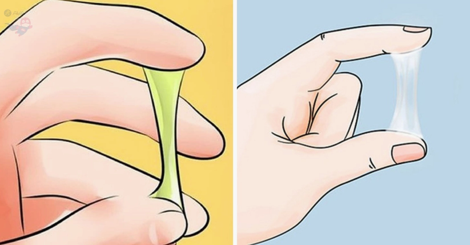 Nước ối: Chức năng, bất thường và cách theo dõi thai kỳ Phân biệt nước ối và huyết trắng