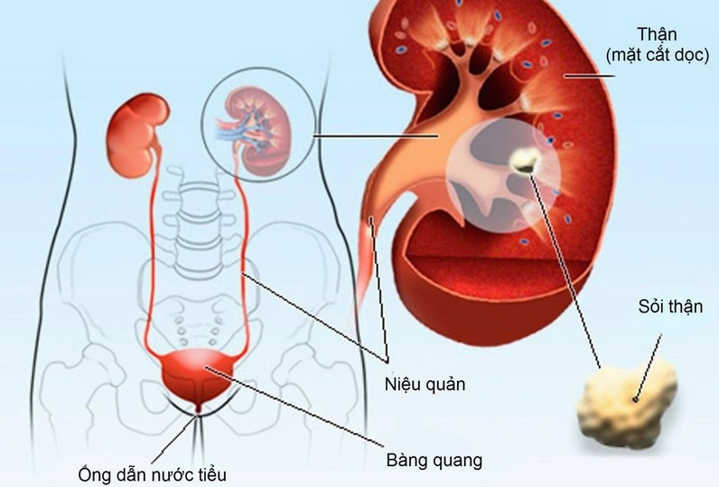 Độ pH trong nước tiểu là gì? Ý nghĩa và cách kiểm tra chính xác Que thử pH nước tiểu