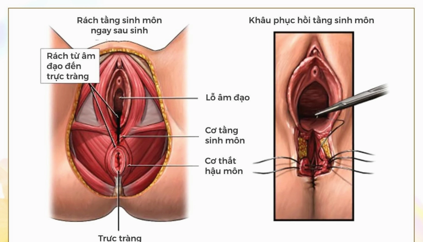 tang-sinh-mon-cam-nang-toan-dien-cho-suc-khoe-phu-nu-2026_198