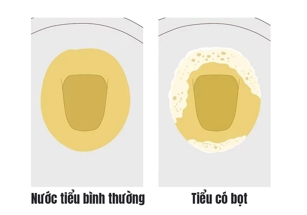 Lời khuyên cho sức khỏe hệ tiết niệu